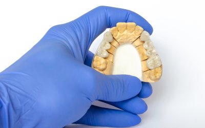 Fixed Dental Bridges: A Reliable Solution for Missing Teeth