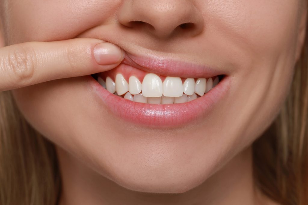 A Woman showing her healthy gums.