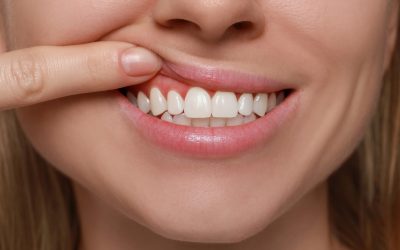 What Is Periodontal (Gum) Disease? Causes, Types & Symptoms